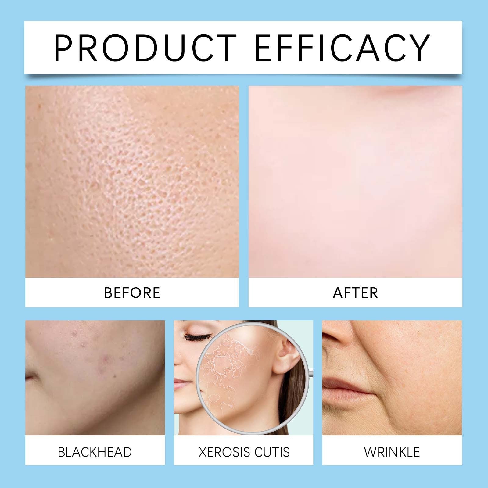 Hyaluronic Acid Face Serum - East Pass Shopping Store