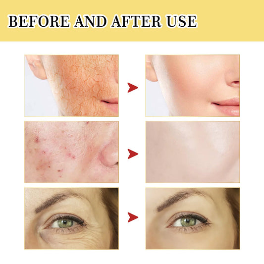 Snail Collagen Facial Serum for Hydrated, Radiant Skin - East Pass Shopping Store